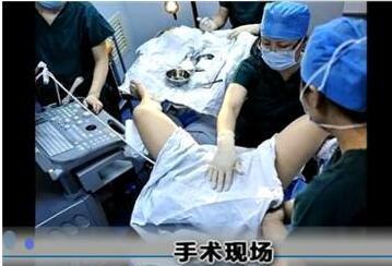 用针刺穿乳头视频